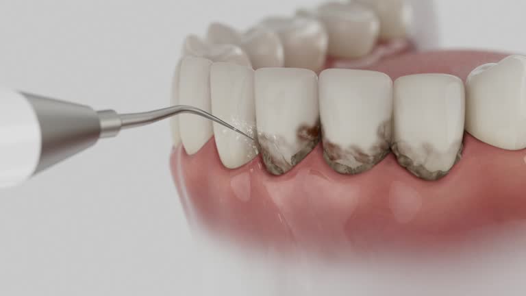 Reliable Wisdom Tooth Removal contractor in Oglethorpe County County, GA by Dentist Open Now